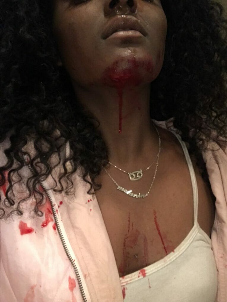 Lady who suffered domestic violence shares pictures of the injury sustained
