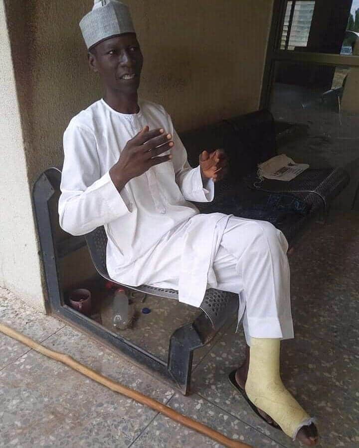 Man who trekked from Yola to Abuja in celebration of Buhari develops leg injury