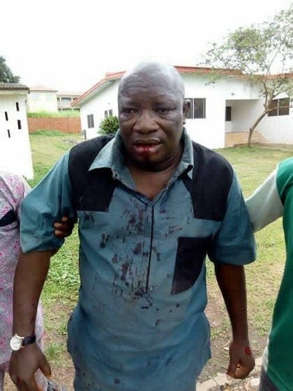 Osun election: Pictures of PDP agent beaten to stupor
